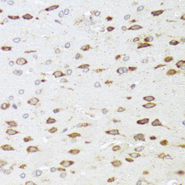 Anti-ARHGAP5 Antibody (CAB3587)