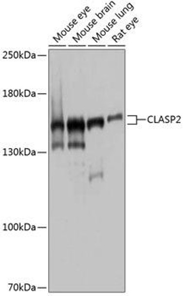 Anti-CLASP2 Antibody (CAB4528)