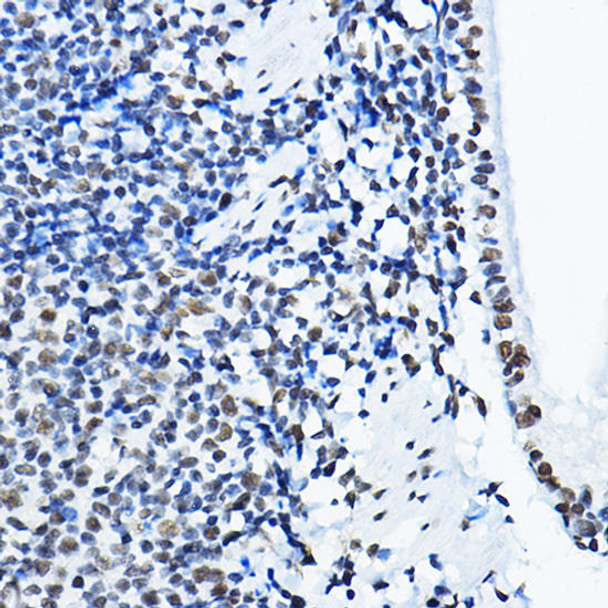 Anti-NONO Antibody (CAB5282)