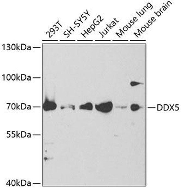 Anti-DDX5 Antibody (CAB5296)