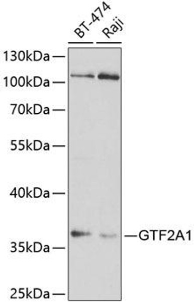 Anti-GTF2A1 Antibody (CAB5345)