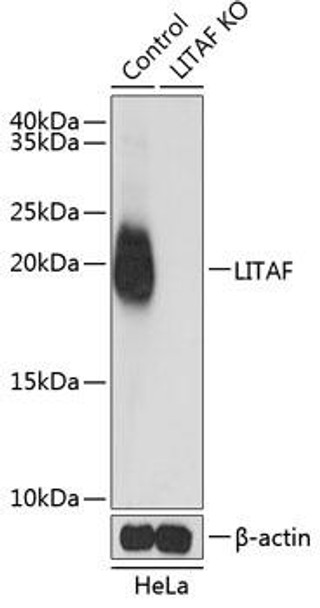 Anti-LITAF Antibody (CAB5469)[KO Validated]