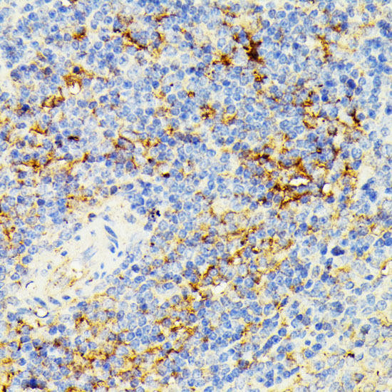 Anti-ECE1 Antibody (CAB5638)[KO Validated]