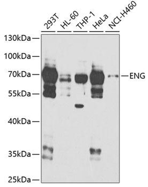 Anti-ENG Antibody (CAB5639)