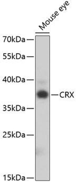 Anti-CRX Antibody (CAB5719)