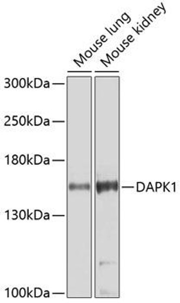 Anti-DAPK1 Antibody (CAB5741)