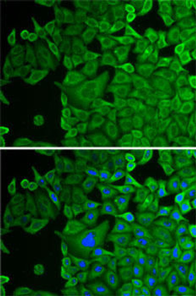 Anti-p53 Antibody (CAB5804)