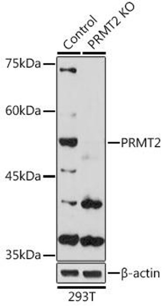 Anti-PRMT2 Antibody (CAB5835)[KO Validated]