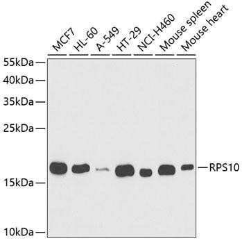 Anti-RPS10 Antibody (CAB5880)