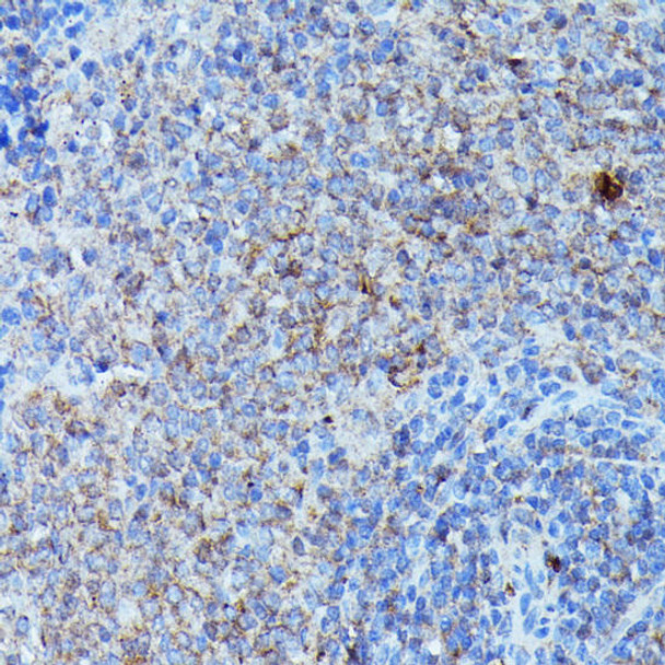 Anti-CSF3 Antibody (CAB6178) Anti-CSF3 Antibody (CAB6178)