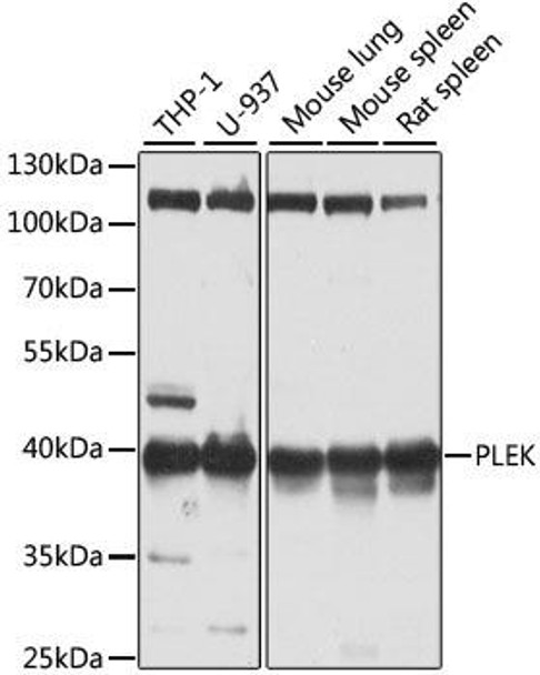 Anti-PLEK Antibody (CAB6305)