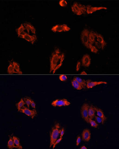 Anti-FAP Antibody (CAB6349)