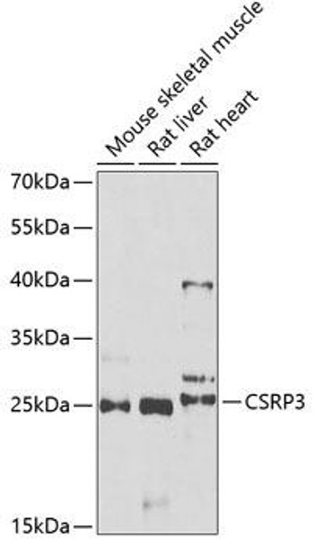 Anti-CSRP3 Antibody (CAB6569)