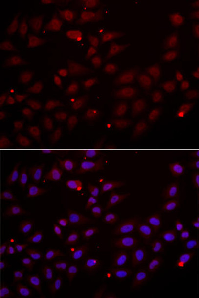 Anti-CST2 Antibody (CAB6571)