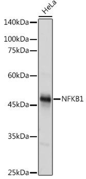 Anti-NFKB1 Antibody (CAB6667)[KO Validated]