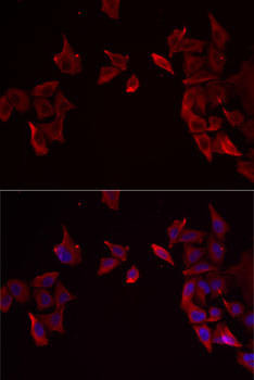 Anti-RAMP3 Antibody (CAB6715)
