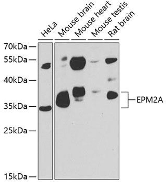 Anti-EPM2A Antibody (CAB7007)