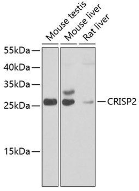 Anti-CRISP2 Antibody (CAB7177)