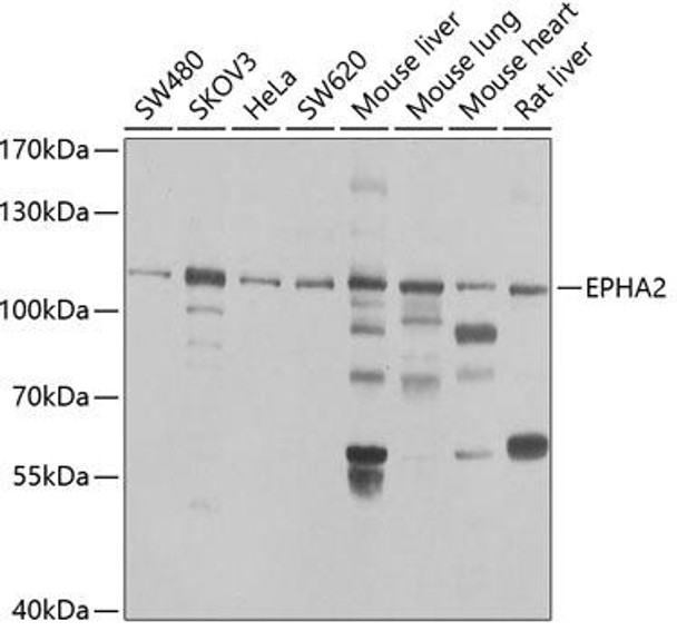 Anti-EPHA2 Antibody (CAB7183)