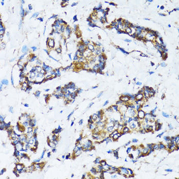 Anti-ATG7 Antibody (CAB7360)