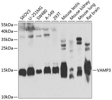 Anti-VAMP3 Antibody (CAB7457)