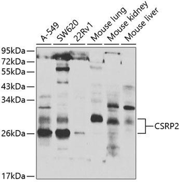Anti-CSRP2 Antibody (CAB7549)