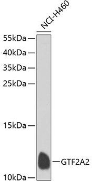 Anti-GTF2A2 Antibody (CAB7680)