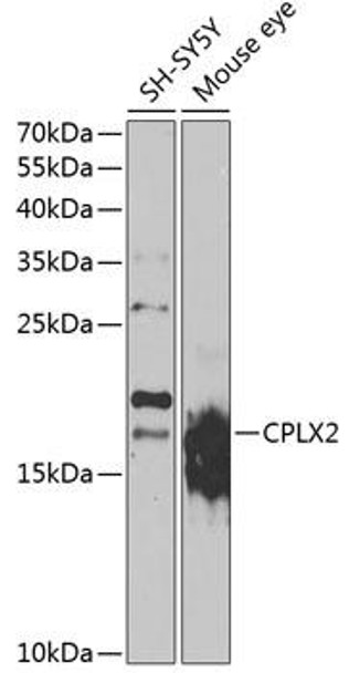 Anti-CPLX2 Antibody (CAB7774)