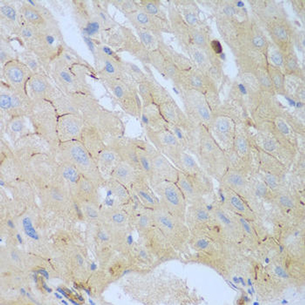 Anti-CEACAM7 Antibody (CAB8112)