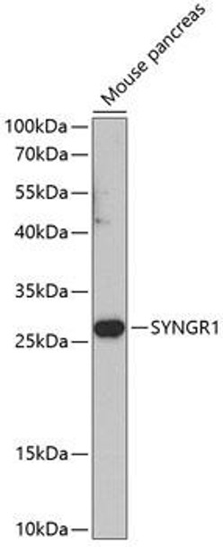 Anti-Synaptogyrin-1 Antibody (CAB8175)