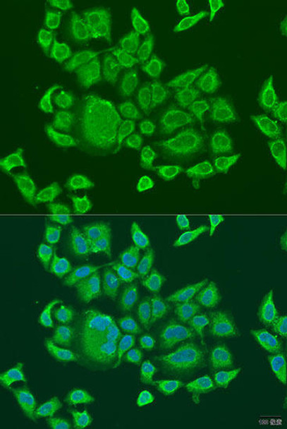 Anti-DHX58 Antibody (CAB8257)
