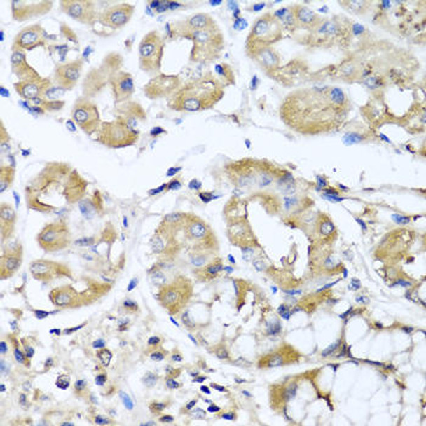 Anti-Interferon lambda-1 Antibody (CAB8288)