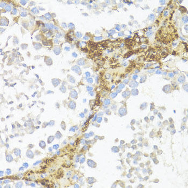 Anti-AMH Antibody (CAB8538)