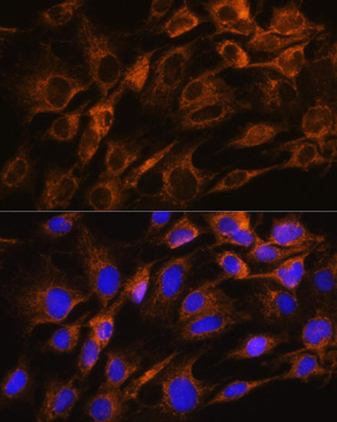 Anti-Aquaporin-8 Antibody (CAB8539)