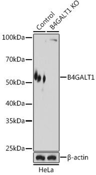 Anti-B4GALT1 Antibody (CAB8546)