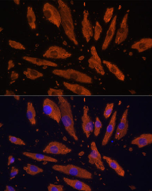 Anti-SIRPA Antibody (CAB9001)