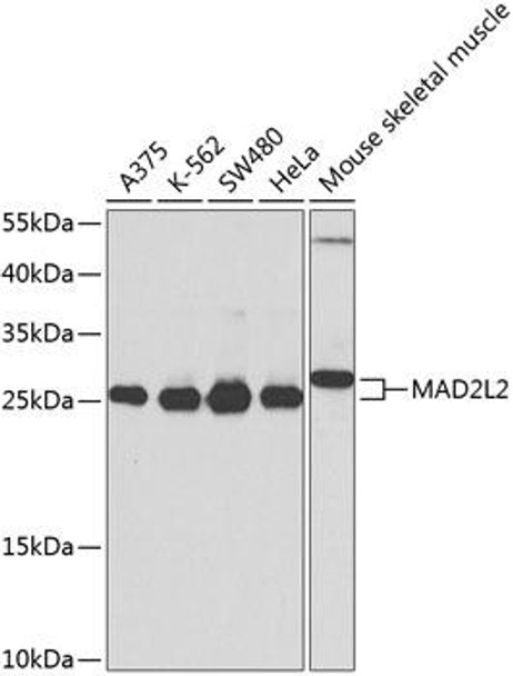 Anti-MAD2L2 Antibody (CAB9861)