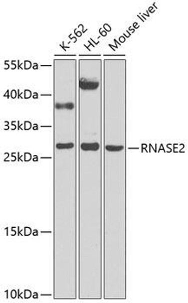 Anti-RNASE2 Antibody (CAB9949)