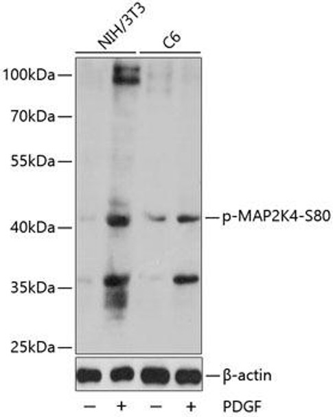 Anti-Phospho-MAP2K4-S80 Antibody (CABP0067) Anti-Phospho-MAP2K4-S80 Antibody (CABP0067)