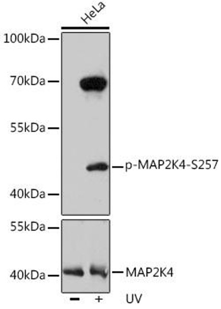 Anti-Phospho-MAP2K4-S257 Antibody (CABP0068) Anti-Phospho-MAP2K4-S257 Antibody (CABP0068)