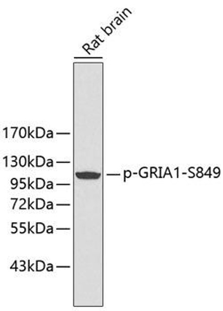 Anti-Phospho-GRIA1-S849 Antibody (CABP0242) Anti-Phospho-GRIA1-S849 Antibody (CABP0242)