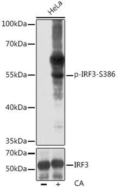 Anti-Phospho-IRF3-S386 pAb Antibody (CABP0857)