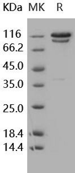 C2/Complement Component 2 Recombinant Protein (RPES0179)