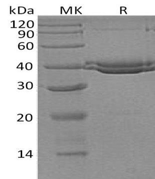 Human SUMF1 Recombinant Protein (RPES0280)