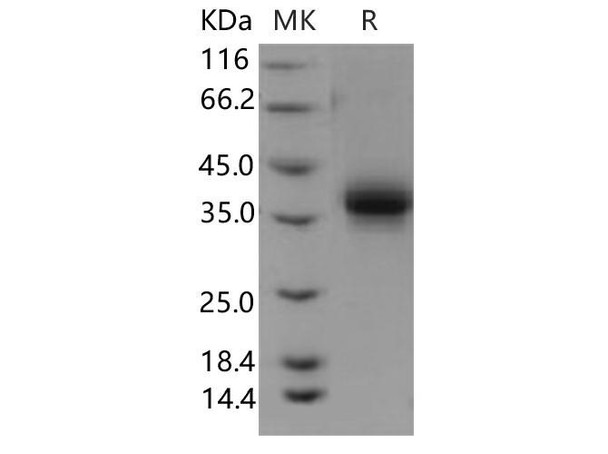 Human EPCR Recombinant Protein (RPES0288)