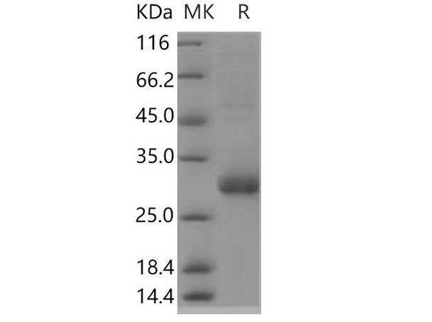 Human TMED1 Recombinant Protein (RPES0307)