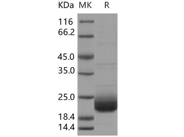 Human LAIR2/CD306 Recombinant Protein  (RPES0329)