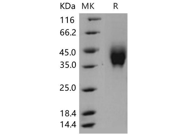 Mouse IFNGR2 Recombinant Protein (RPES0370)