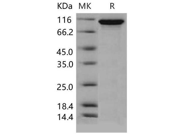 Mouse Autotaxin/ENPP2 Recombinant Protein (RPES0389)