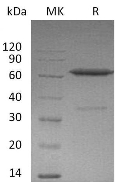 Mouse Ephrin-A3/EFNA3 Recombinant Protein (RPES0475)